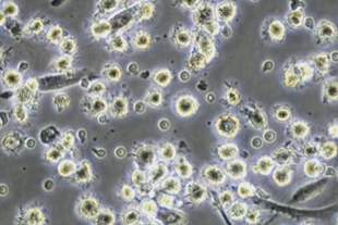 Harvest cells-4.png Harvest cells-4.png